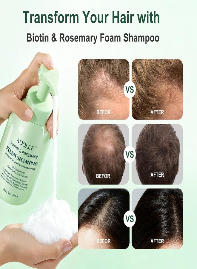 AOOLCF Biotin & Rosemary Shampoo for Hair Growth, Hair Loss Shampoo for Men and Women, 12-Component Synergistic Blend for Visibly Thicker Hair - 13.53 fl oz (Pack of 2) - Image 2